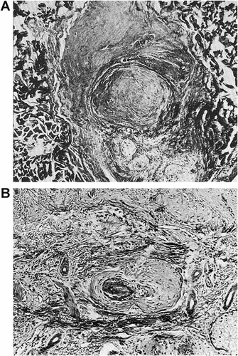 Details are in the caption following the image