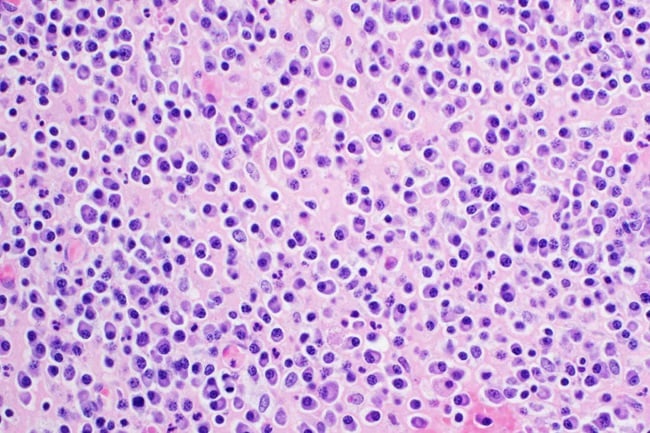 Chimeric antigen-T cells and bispecific antibodies